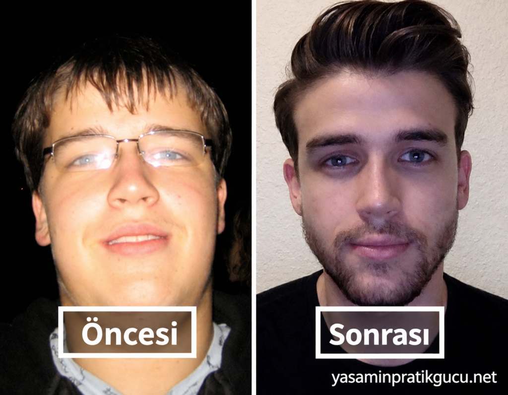Yağ Oranının Çekiciliğe 5 Olumsuz Etkisi 2 Yağ Oranının Çekiciliğe 5 Olumsuz Etkisi
